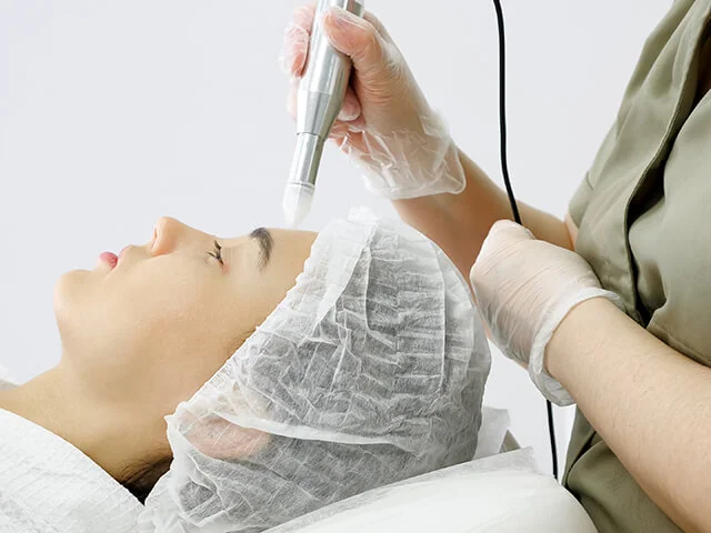 Benefícios da limpeza de pele com peeling