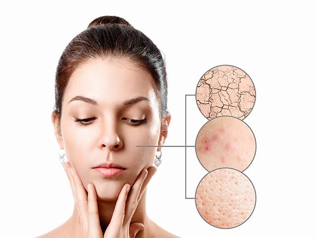 Benefícios da Limpeza de pele 4